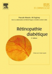 Rétinopathie diabétique. 2e édition