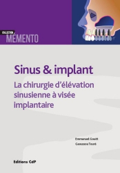 Sinus et implant : la chirurgie d'élévation sinusienne à visée implantaire