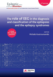 The role of EEG in the diagnosis and classification of the epilepsies and the epilepsy syndromes