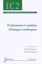 Traitement et analyse d'images cardiaques
