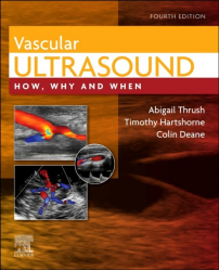 Vascular Ultrasound : How, Why and When