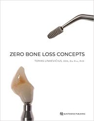 Zero bone loss concept