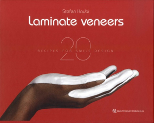 Laminate Veneers - quintessence international - 9782366150551 - 